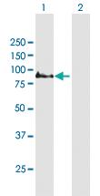 Anti-COMP Mouse Polyclonal Antibody