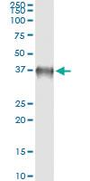 Anti-BOLL Mouse Monoclonal Antibody [clone: 2G4]