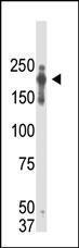 Anti-PRDM2 Mouse Monoclonal Antibody (AP (Alkaline Phosphatase)) [clone: 33AT1045]