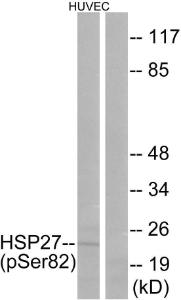 Western blot analysis of lysates from HUVEC cells treated with TNF 20ng/ml 30' using Anti-HSP27 (phospho Ser82) Antibody. The right hand lane represents a negative control, where the antibody is blocked by the immunising peptide