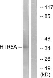 Anti-HTR5A antibody