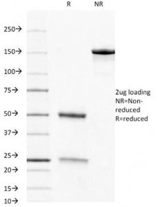 SDS-PAGE analysis of Anti-CD8A Antibody [C8/468] under non-reduced and reduced conditions; showing intact IgG and intact heavy and light chains, respectively. SDS-PAGE analysis confirms the integrity and purity of the antibody