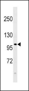 Anti-FGFR4 Rabbit Polyclonal Antibody (AP (Alkaline Phosphatase))