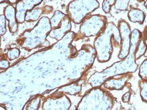 Antibody anti-EGFR SPM341 100 µg