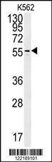 Anti-PAOX Rabbit Polyclonal Antibody (AP (Alkaline Phosphatase))