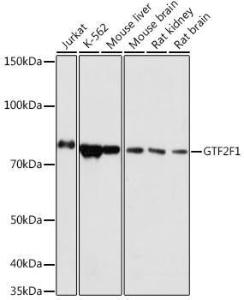 Western blot analysis of extracts of various cell lines, using Anti-TFIIF Antibody (A308239) at 1:1000 dilution. The secondary Antibody was Goat Anti-Rabbit IgG H&L Antibody (HRP) at 1:10000 dilution. Lysates/proteins were present at 25 µg per lane