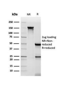 SDS-PAGE analysis of Anti-CD48 Antibody [CD48/4786] under non-reduced and reduced conditions; showing intact IgG and intact heavy and light chains, respectively. SDS-PAGE analysis confirms the integrity and purity of the antibody