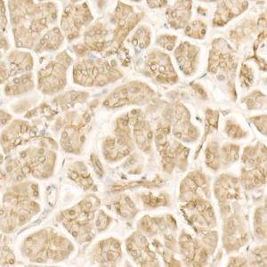 Immunohistochemistry analysis of paraffin-embedded human pancreas using Anti-beta Catenin Antibody (A12611) at dilution of 20 (40x lens). Perform high pressure antigen retrieval with 10 mM citrate buffer pH 6.0 before commencing with IHC staining protocol