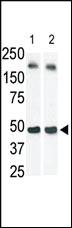 Anti-SPHK1 Rabbit Polyclonal Antibody