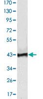 Anti-ATP2C1 Mouse Monoclonal Antibody [clone: 4G12]