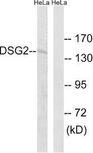 Anti-DSG2 antibody