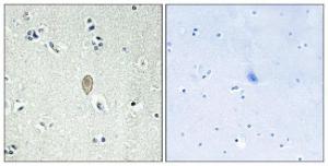 Immunohistochemical analysis of paraffin-embedded human brain tissue using Anti-FZD5 Antibody The right hand panel represents a negative control, where the antibody was pre-incubated with the immunising peptide