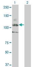 Anti-KIT Mouse Monoclonal Antibody [clone: 5A11]