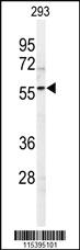 Anti-SPHK1 Rabbit Polyclonal Antibody