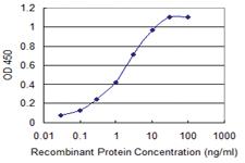 Anti-KIT Mouse Monoclonal Antibody [clone: 5A11]