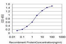 Anti-HOXB7 Mouse Monoclonal Antibody [clone: 4C6]