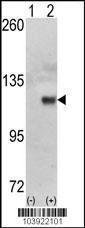 Anti-HK1 Rabbit Polyclonal Antibody (AP (Alkaline Phosphatase))