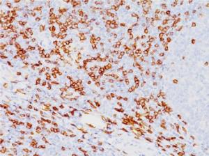 Immunohistochemical analysis of formalin-fixed, paraffin-embedded human tonsil using Anti-CD8A Antibody [SPM548]