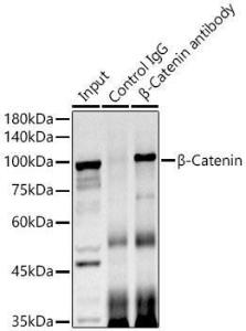 Immunoprecipitation analysis of 600 µg extracts of mouse brain using 3 µg of Anti-beta Catenin Antibody (A12611). This Western blot was performed on the immunoprecipitate using Anti-beta Catenin Antibody (A12611) at a dilution of 1:1000