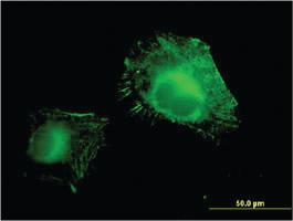 Anti-AOC3 Mouse Monoclonal Antibody [clone: 4B8]