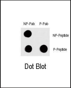 Anti-FOS Rabbit Polyclonal Antibody (Biotin)