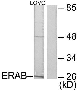 Western blot analysis of lysates from LOVO cells using Anti-ERAB Antibody. The right hand lane represents a negative control, where the Antibody is blocked by the immunising peptide