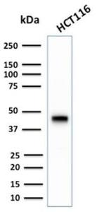 Anti-Cytokeratin 18 Rabbit Recombinant Antibody [clone: KRT18/2808R]