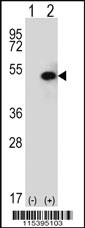 Anti-SPHK1 Rabbit Polyclonal Antibody