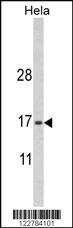 Anti-PRDM6 Rabbit Polyclonal Antibody