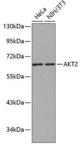 Western blot analysis of extracts of various cell lines, using Anti-AKT2 Antibody (A12613) The secondary antibody was Goat Anti-Rabbit IgG H&L Antibody (HRP) at 1:10,000 dilution Lysates/proteins were present at 25 µg per lane