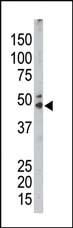 Anti-SPHK1 Rabbit Polyclonal Antibody