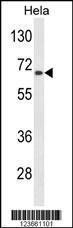 Anti-AGXT2 Rabbit Polyclonal Antibody (HRP (Horseradish Peroxidase))