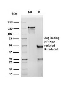 SDS-PAGE analysis of Anti-CD8A Antibody [SPM548] under non-reduced and reduced conditions; showing intact IgG and intact heavy and light chains, respectively. SDS-PAGE analysis confirms the integrity and purity of the antibody.