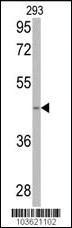 Anti-SPHK1 Rabbit Polyclonal Antibody