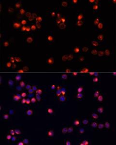 Immunofluorescence analysis of HeLa cells using Anti-AKT2 Antibody (A12613) at a dilution of 1:100 DAPI was used to stain the cell nuclei (blue)