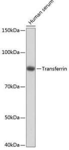 Western blot analysis of extracts of Human serum, using Anti-Transferrin Antibody [ARC0338] (A308242) at 1:1,000 dilution The secondary antibody was Goat Anti-Rabbit IgG H&L Antibody (HRP) at 1:10,000 dilution Lysates/proteins were present at 25 µg per lane