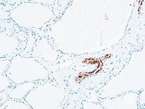 Immunohistochemical analysis of paraffin-embedded human Thyroid using Anti-DNTT Antibody