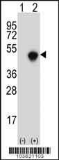 Anti-SPHK1 Rabbit Polyclonal Antibody