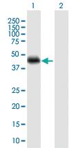 Anti-CRELD1 Rabbit Polyclonal Antibody