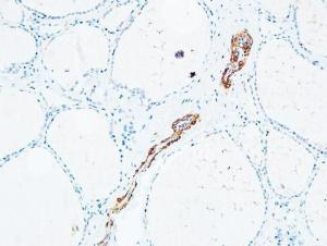 Immunohistochemical analysis of paraffin-embedded human Thyroid using Anti-DNTT Antibody