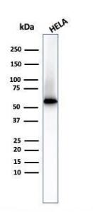 Antibody anti-FASCIN FSCN1417 BSA 100 µg