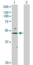 Anti-FOXJ1 Rabbit Polyclonal Antibody