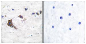 Immunohistochemical analysis of paraffin-embedded human brain tissue using Anti-ERAB Antibody. The right hand panel represents a negative control, where the Antibody was pre-incubated with the immunising peptide