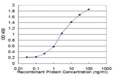 Anti-FOXC2 Mouse Monoclonal Antibody [clone: 3H3]