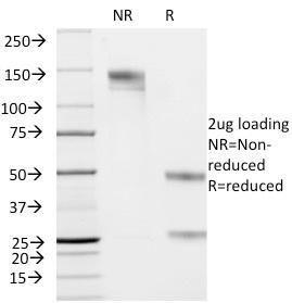 SDS-PAGE analysis of Anti-Cytokeratin 19 Antibody [KRT19/799] under non-reduced and reduced conditions; showing intact IgG and intact heavy and light chains, respectively. SDS-PAGE analysis confirms the integrity and purity of the antibody