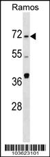 Anti-SPHK2 Rabbit Polyclonal Antibody