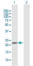 Anti-NMRK1 Rabbit Polyclonal Antibody