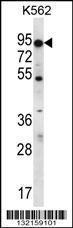 Anti-ABCD2 Rabbit Polyclonal Antibody (PE (Phycoerythrin))