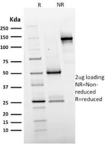 Anti-EGFR antibody