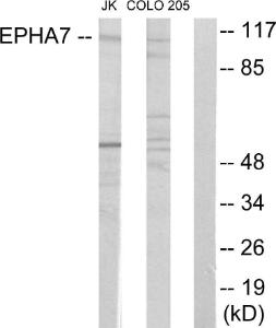 Western blot analysis of lysates from Jurkat cells and COLO205 cells using Anti-EPHA7 Antibody The right hand lane represents a negative control, where the antibody is blocked by the immunising peptide